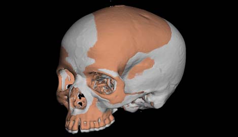 Transformed and registered surfaces of human crania in a Generalised Procrustes Analysis